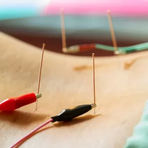 Acupuncture